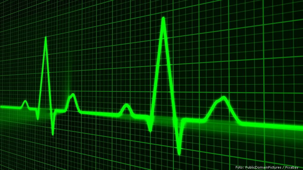 pulse trace 163708 1280